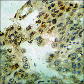 Anti-phospho-BTK (pTyr223) antibody produced in rabbit affinity isolated antibody