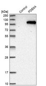 Anti-PDE6A antibody produced in rabbit Prestige Antibodies&#174; Powered by Atlas Antibodies, affinity isolated antibody, buffered aqueous glycerol solution