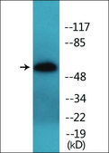 Anti-phospho-TIP60 (pSer86) antibody produced in rabbit affinity isolated antibody