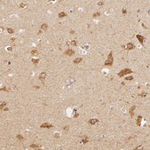 Anti-APP antibody produced in rabbit Prestige Antibodies&#174; Powered by Atlas Antibodies, affinity isolated antibody, buffered aqueous glycerol solution