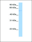 Anti-CYP1A1 (AB2) affinity isolated antibody
