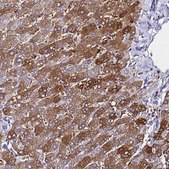 Anti-FTL antibody produced in rabbit Prestige Antibodies&#174; Powered by Atlas Antibodies, affinity isolated antibody, buffered aqueous glycerol solution