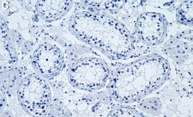 Anti-HSP90&#946; Antibody, clone 2E21 ZooMAb&#174; Rabbit Monoclonal recombinant, expressed in HEK 293 cells