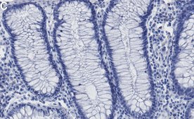 Anti-HMGA1 Antibody, clone 1F20 ZooMAb&#174; Rabbit Monoclonal recombinant, expressed in HEK 293 cells