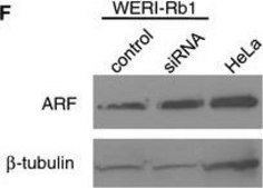 Anti-β-Tubulin antibody, Mouse monoclonal clone D66, purified from hybridoma cell culture