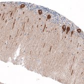 Anti-JAG2 antibody produced in rabbit Prestige Antibodies&#174; Powered by Atlas Antibodies, affinity isolated antibody, buffered aqueous glycerol solution