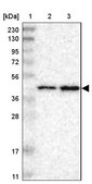 Anti-PRMT2 antibody produced in rabbit Prestige Antibodies&#174; Powered by Atlas Antibodies, affinity isolated antibody, buffered aqueous glycerol solution