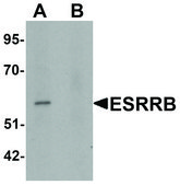 Anti-ESRRB antibody produced in rabbit affinity isolated antibody