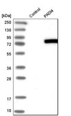 Anti-PADI4 antibody produced in rabbit Prestige Antibodies&#174; Powered by Atlas Antibodies, affinity isolated antibody, buffered aqueous glycerol solution