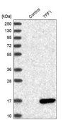Anti-TFF1 antibody produced in rabbit Prestige Antibodies&#174; Powered by Atlas Antibodies, affinity isolated antibody, buffered aqueous glycerol solution