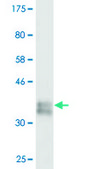 Monoclonal Anti-COL1A1 antibody produced in mouse clone 3G3, purified immunoglobulin, buffered aqueous solution