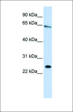 Anti-ZNF326 antibody produced in rabbit affinity isolated antibody