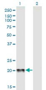 Anti-CGB antibody produced in mouse purified immunoglobulin, buffered aqueous solution
