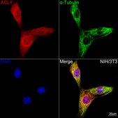 Anti-ACLY Antibody, clone 8A0V0, Rabbit Monoclonal