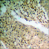 Anti-phospho-Parkin (pSer131) antibody produced in rabbit affinity isolated antibody