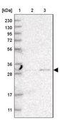 Anti-TPMT antibody produced in rabbit Prestige Antibodies&#174; Powered by Atlas Antibodies, affinity isolated antibody, buffered aqueous glycerol solution