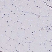 Anti-MGST1 antibody produced in rabbit Prestige Antibodies&#174; Powered by Atlas Antibodies, affinity isolated antibody, buffered aqueous glycerol solution