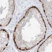 Anti-MGEA5 antibody produced in rabbit Prestige Antibodies&#174; Powered by Atlas Antibodies, affinity isolated antibody, buffered aqueous glycerol solution