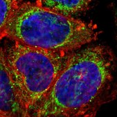 Anti-PHB antibody produced in rabbit Prestige Antibodies&#174; Powered by Atlas Antibodies, affinity isolated antibody, buffered aqueous glycerol solution