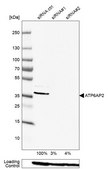 Anti-ATP6AP2 antibody produced in rabbit affinity isolated antibody, buffered aqueous glycerol solution