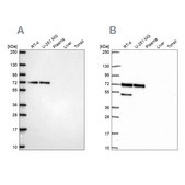 Anti-PAK4 antibody produced in rabbit Prestige Antibodies&#174; Powered by Atlas Antibodies, affinity isolated antibody