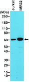 Anti-SMAD4 antibody, Rabbit monoclonal recombinant, expressed in HEK 293 cells, clone RM277, purified immunoglobulin
