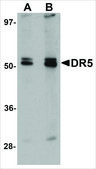 Anti-DR5 antibody produced in rabbit affinity isolated antibody, buffered aqueous solution