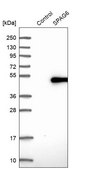 Anti-SPAG6 antibody produced in rabbit Prestige Antibodies&#174; Powered by Atlas Antibodies, affinity isolated antibody, buffered aqueous glycerol solution