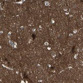 Anti-ATP6V1B2 antibody produced in rabbit Prestige Antibodies&#174; Powered by Atlas Antibodies, affinity isolated antibody, buffered aqueous glycerol solution