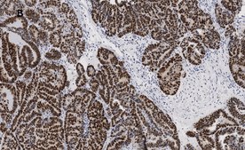 Anti-p53 Antibody, clone 6O23, ZooMAb® Rabbit Monoclonal recombinant, expressed in HEK 293 cells