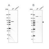 Anti-BTK antibody produced in rabbit Ab1, Prestige Antibodies&#174; Powered by Atlas Antibodies, affinity isolated antibody, buffered aqueous glycerol solution