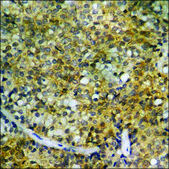 Anti-phospho-HDAC5 (pSer259) antibody produced in rabbit affinity isolated antibody