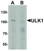 Anti-ULK1 antibody produced in rabbit affinity isolated antibody