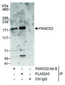 Rabbit anti-FANCD2 Antibody, Affinity Purified Powered by Bethyl Laboratories, Inc.