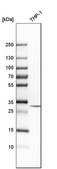 Anti-TPM3 antibody produced in rabbit Prestige Antibodies&#174; Powered by Atlas Antibodies, affinity isolated antibody, buffered aqueous glycerol solution