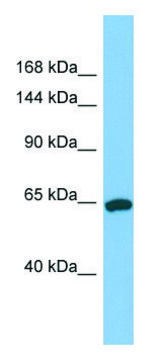 Anti-TPO (N-terminal) antibody produced in rabbit affinity isolated antibody