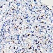 Anti- Cyclin D1 antibody produced in rabbit