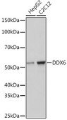 Anti-DDX6 Antibody, clone 6F9I6, Rabbit Monoclonal