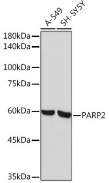 Anti-PARP2 Antibody, clone 6G5U7, Rabbit Monoclonal
