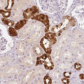 Anti-CALB1 antibody produced in rabbit Prestige Antibodies&#174; Powered by Atlas Antibodies, affinity isolated antibody, buffered aqueous glycerol solution