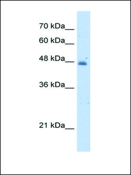 Anti-KYNU (AB2) antibody produced in rabbit IgG fraction of antiserum
