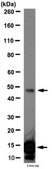 Anti-acetyl-p53 (Lys320) Antibody from rabbit, purified by affinity chromatography