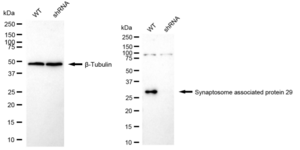 KD-Validated Anti Synaptosome Associated Protein 29 Antibody, clone 24GB1855, Rabbit Monoclonal clone 24GB1855, recombinant rabbit monoclonal, expressed in HEK293 cells