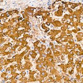 Anti-Cathepsin L/V/K/H Antibody, clone 2Q10F10, Rabbit Monoclonal