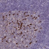 Anti-CD38 antibody produced in rabbit Prestige Antibodies&#174; Powered by Atlas Antibodies, affinity isolated antibody, buffered aqueous glycerol solution