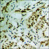 Anti-phospho-Catenin-&#948;1 (pTyr228) antibody produced in rabbit affinity isolated antibody