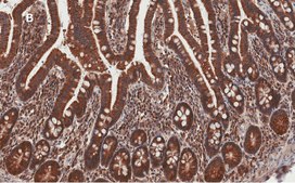 Anti-AMPK alpha Antibody, clone 2D22, ZooMAb&#174; Rabbit Monoclonal recombinant, expressed in HEK 293 cells