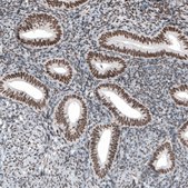 Monoclonal Anti-SETD2 antibody produced in mouse Prestige Antibodies&#174; Powered by Atlas Antibodies, clone CL9956, purified immunoglobulin, buffered aqueous glycerol solution