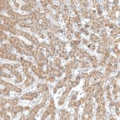 Anti-CPT2 antibody produced in rabbit Prestige Antibodies&#174; Powered by Atlas Antibodies, affinity isolated antibody, buffered aqueous glycerol solution, ab3