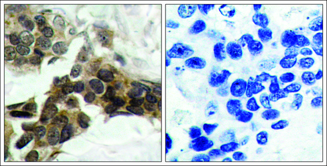 Anti-phospho-NFKBIA (pSer32/pSer36) antibody produced in rabbit affinity isolated antibody